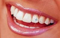 Swarovski Tooth Jewels